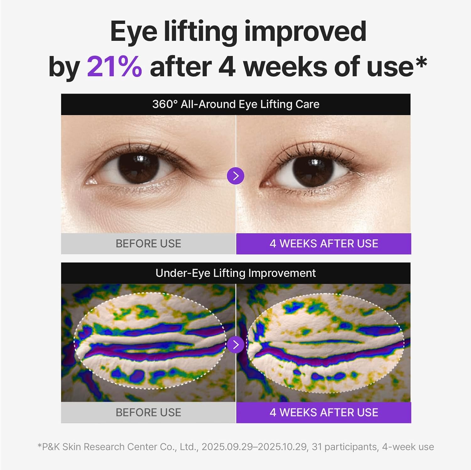 Centellian24 360º Shot PDRN Eye Cream 30mL