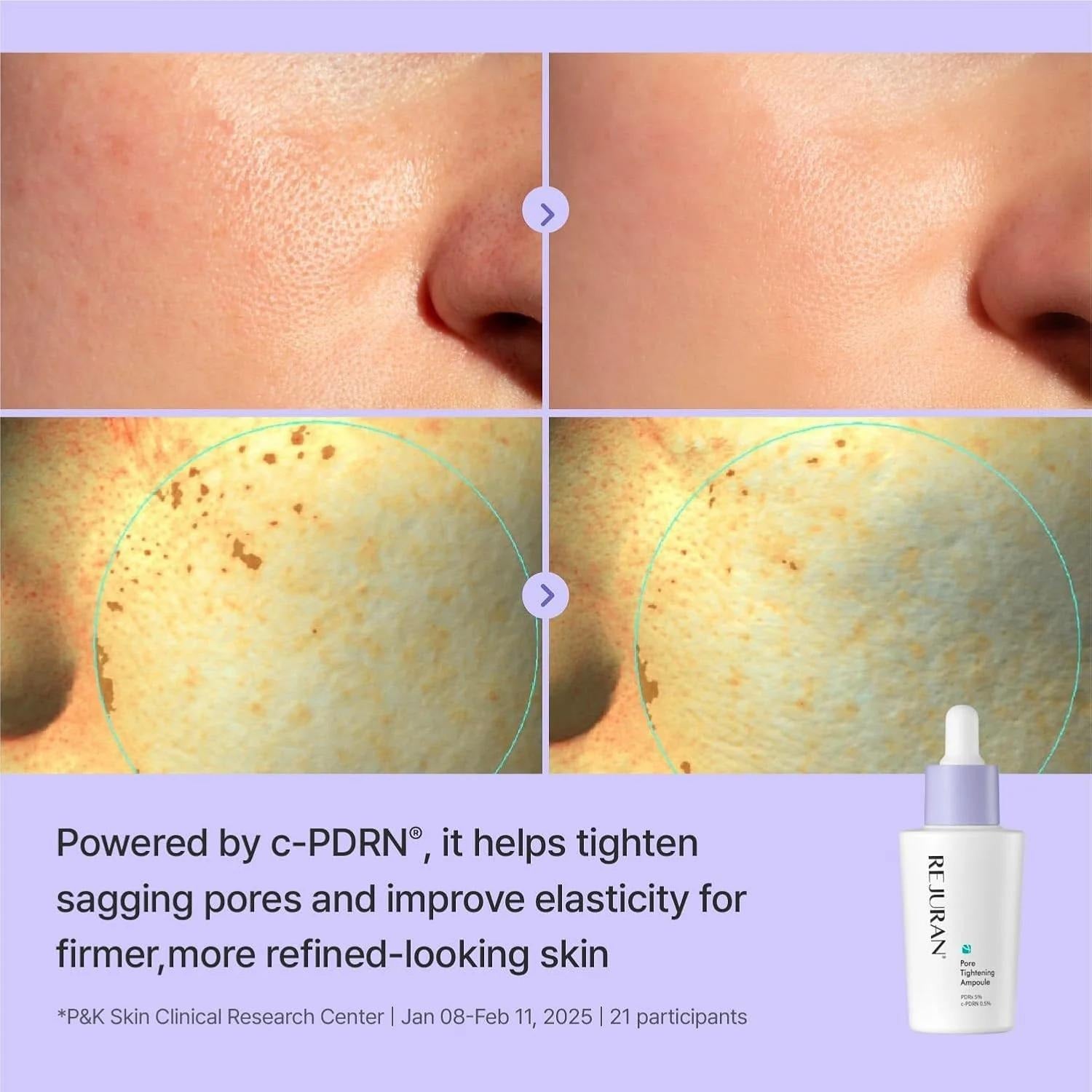 Rejuran Pore Tightening Ampoule 30ml