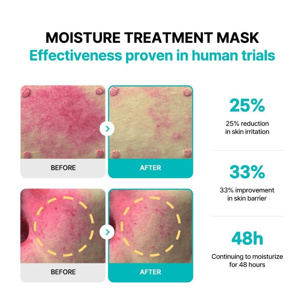 Rejuran Moisture Treatment Mask (23ml X 5S)