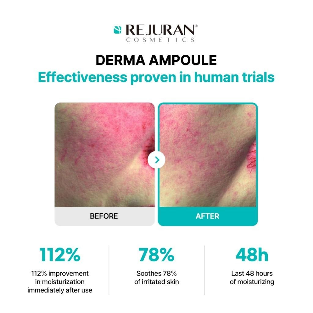 Rejuran Moisture Treatment Ampoule 30ml